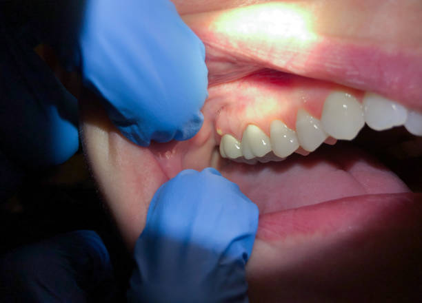 Best Walk-In Emergency Dentist in Martindale, TX